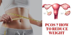 Read more about the article PCOS and Effective Weight Loss Strategies for Women